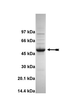 Eurofins DiscoverX SGK1 ( 1-59, S422D) Protein, Active 6 &mu;g | Buy Online | Eurofins DiscoverX | Fisher Scientific